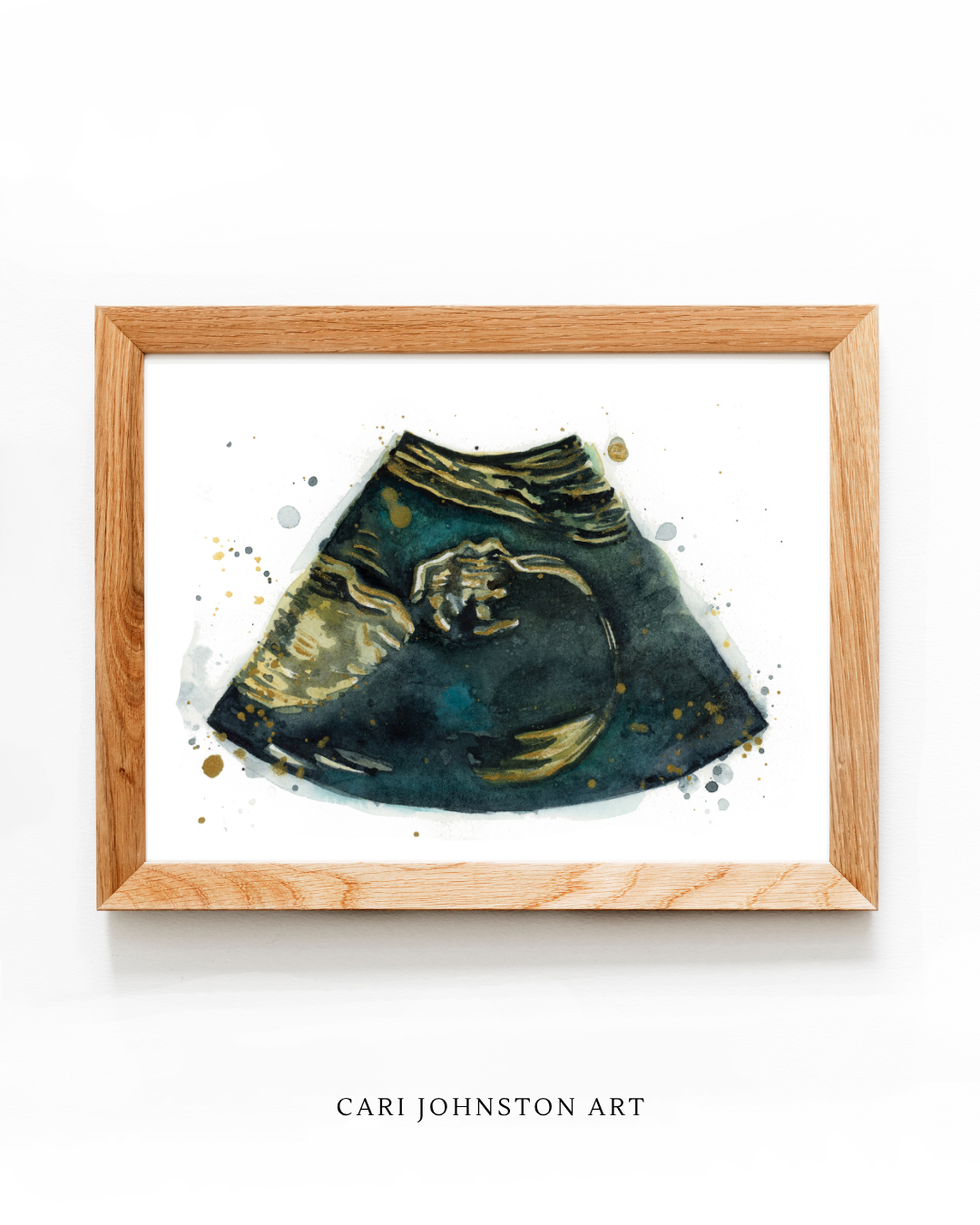 Custom Ultrasound Painting