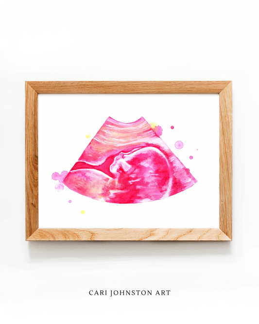 Custom Ultrasound Painting