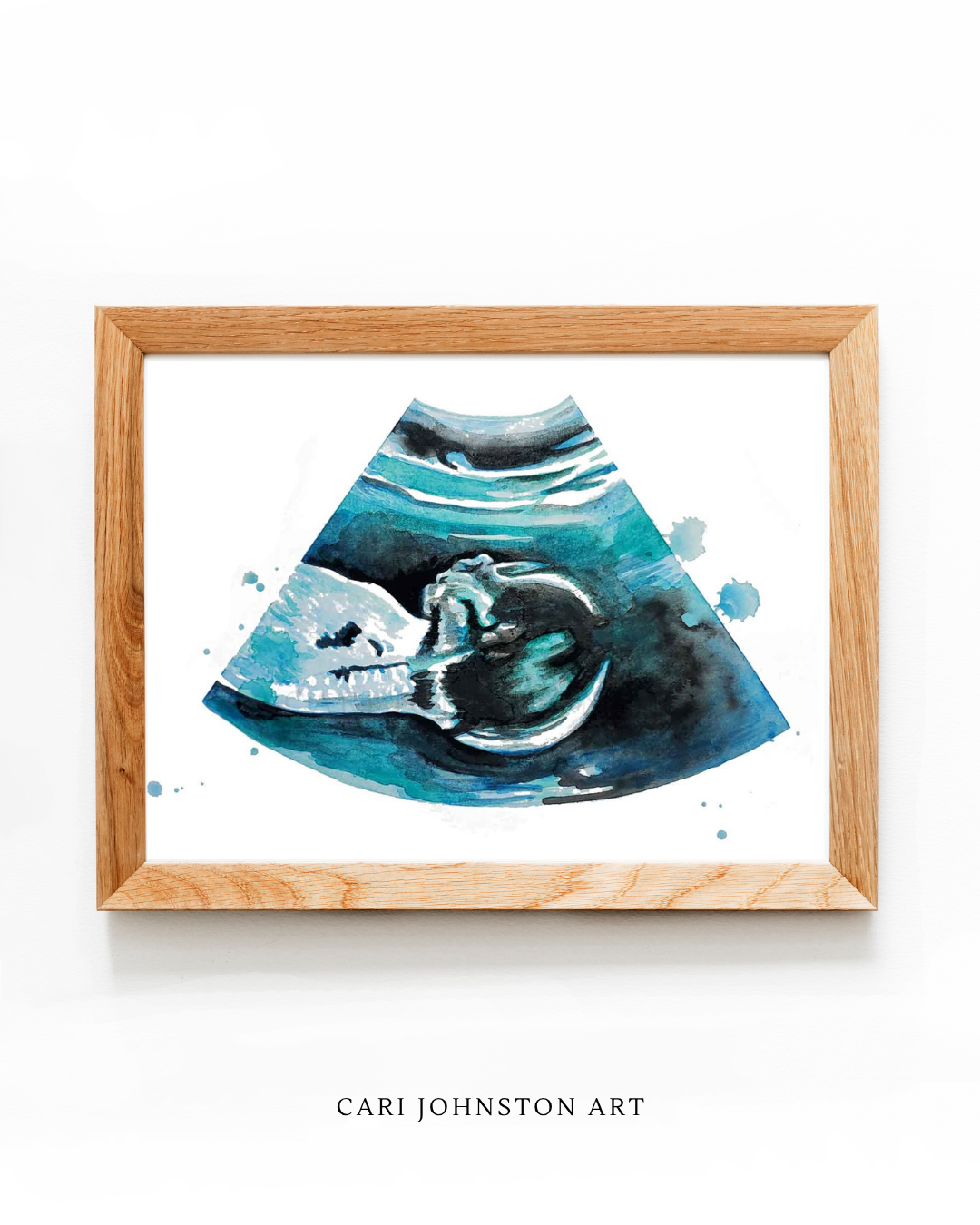 Custom Ultrasound Painting