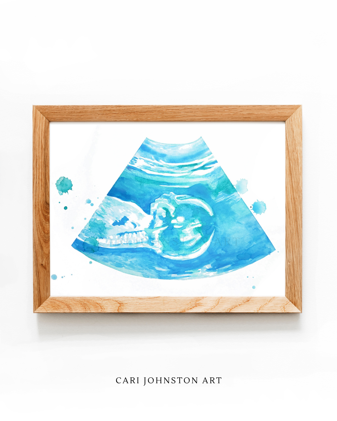 Custom Ultrasound Painting