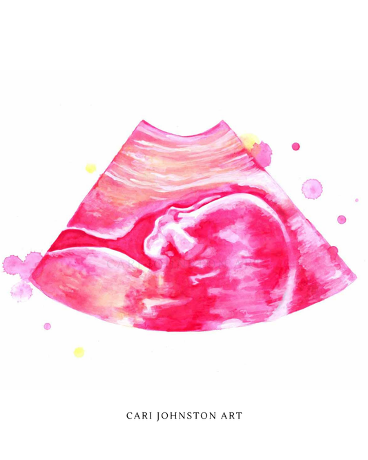 Custom Ultrasound Painting