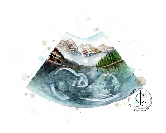 A custom sonogram painting, featuring a colorful and detailed depiction of a baby's ultrasound image, signed by the artist Cari Johnston.